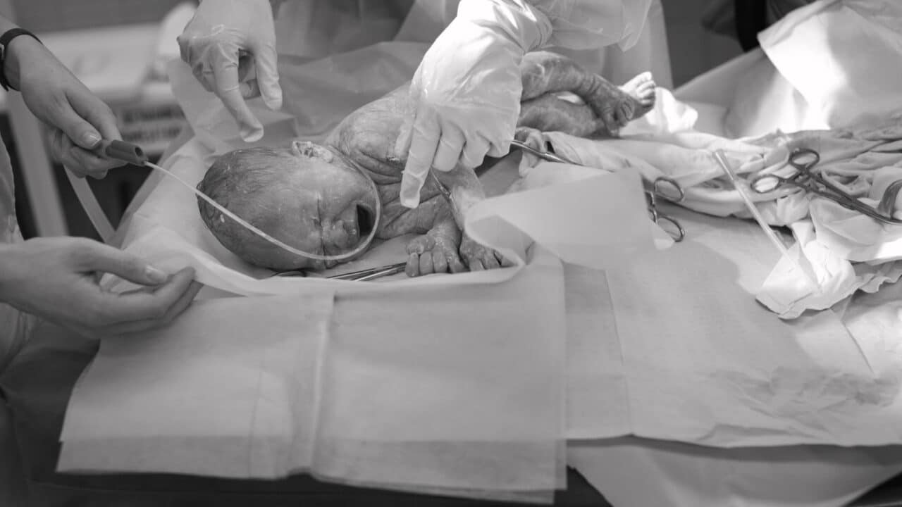 Geburtsschäden und Schmerzensgeld für die Mutter: Rechte und Ansprüche
