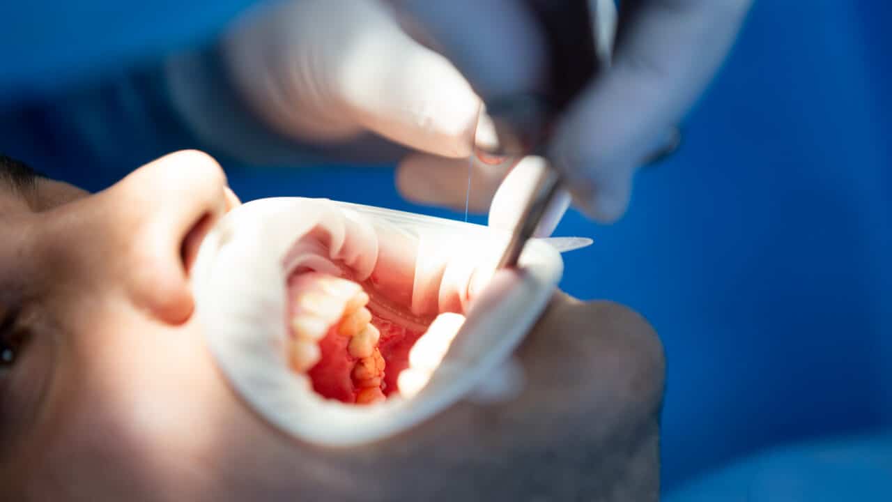 Weisheitszahn OP schief gelaufen: Wann liegt ein Behandlungsfehler vor – und welche Ansprüche haben Sie?